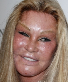 Jocelyn Wildenstein