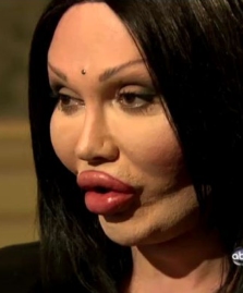 Pete burns